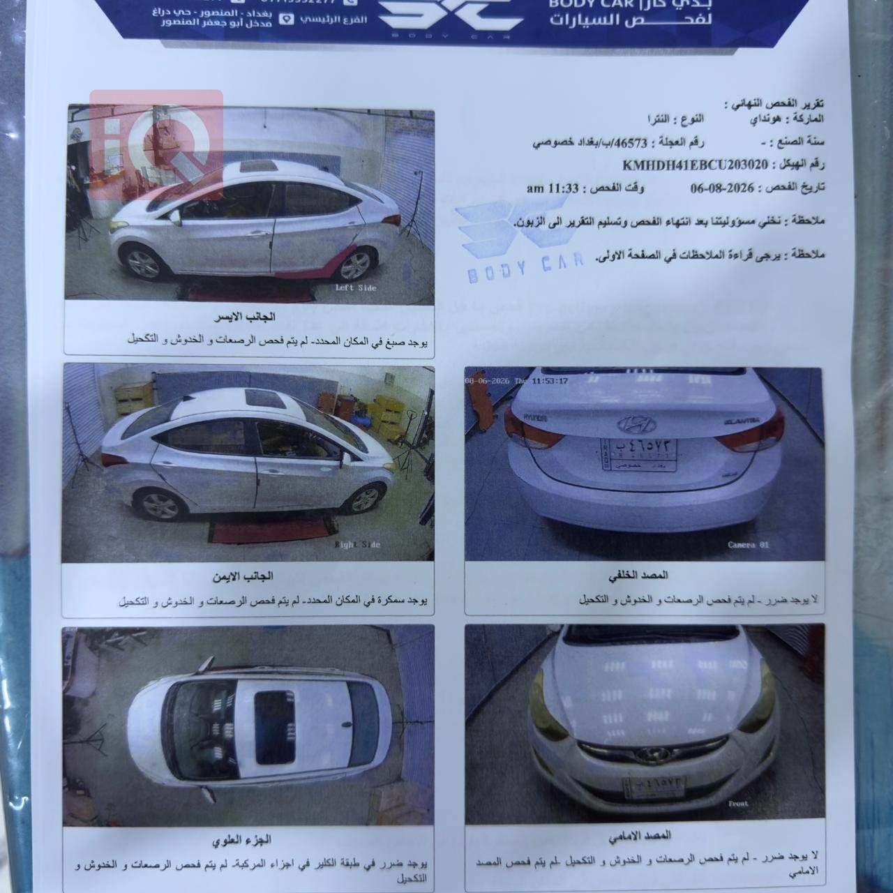 هيونداي النترا